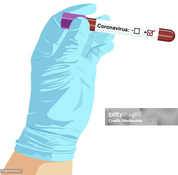 coronavirus test tube - covid 19 stock illustrations