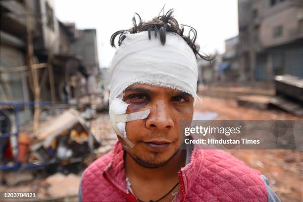 An injured man after communal violence over the Citizenship Amendment Act at Karawal Nagar on February 27, 2020 in New Delhi, India.