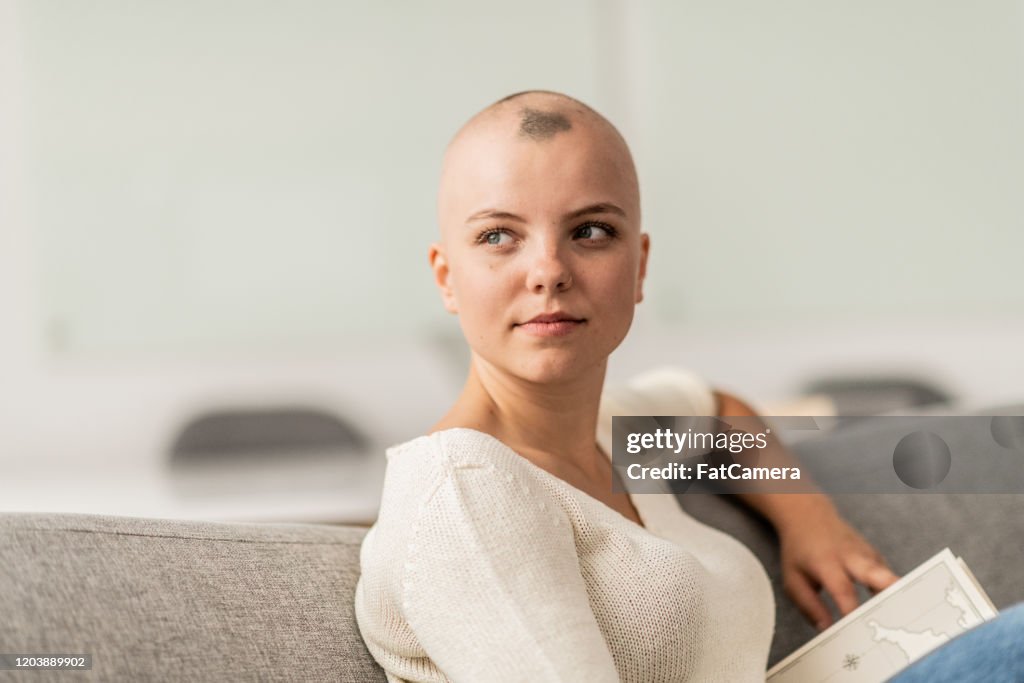 Jonge Vrouw met Alopecia Het lezen van voorraadfoto
