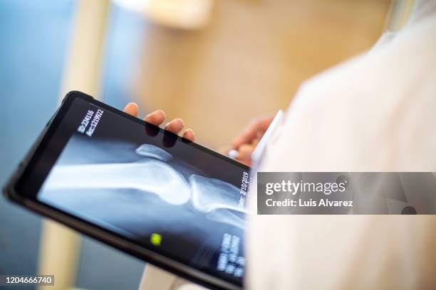 doctor looking at report on digital tablet - knee replacement surgery 個照片及圖片檔