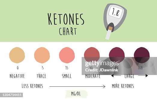 Ketometer Color Ketogenic Reading Infographic Chart Showing Color Coding For Ketone ...