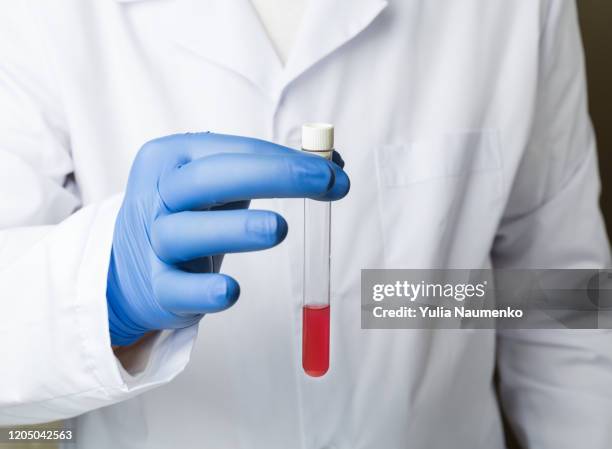 doctor in white coat holds a test tube with red liquid in his hand. healthcare medicine concept, virus test. - doctor coat stock pictures, royalty-free photos & images