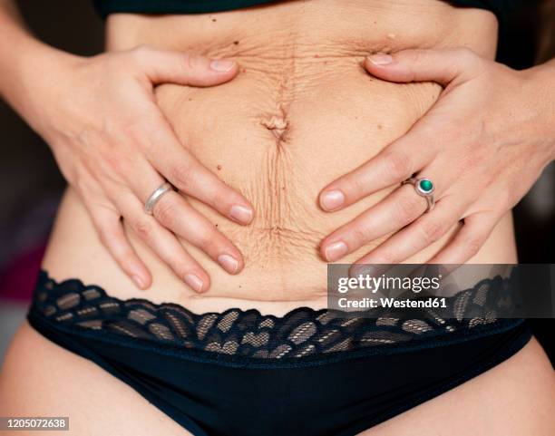 postpartum flabby and wrinkled belly skin with c-section scar - piel flacida fotografías e imágenes de stock