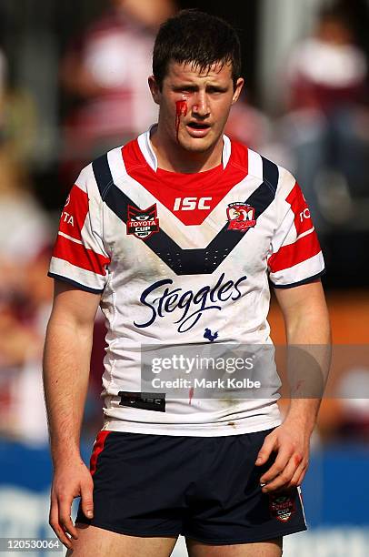 Dane Atkinson of the Roosters bleeds from a cut under his eye during the round 22 Toyota Cup match between the Manly Warringah Sea Eagles and the...