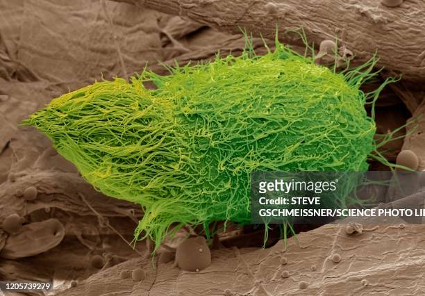 loxophyllum ciliate protozoa, sem - scanning electron micrograph stock pictures, royalty-free photos & images