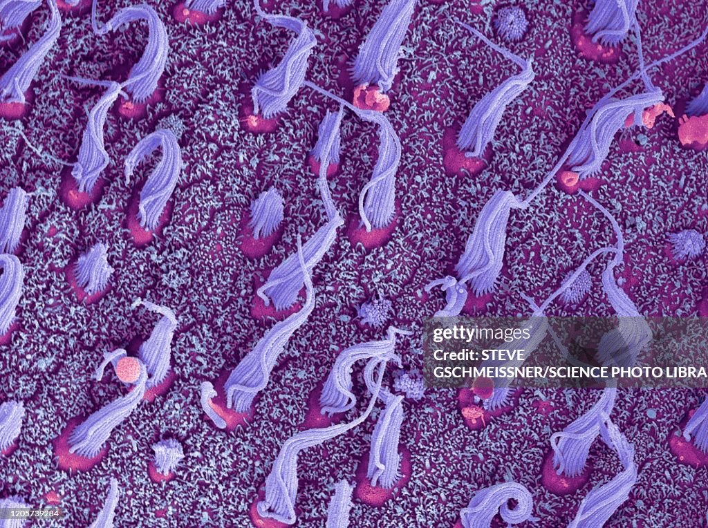 Inner ear sensory cells, SEM