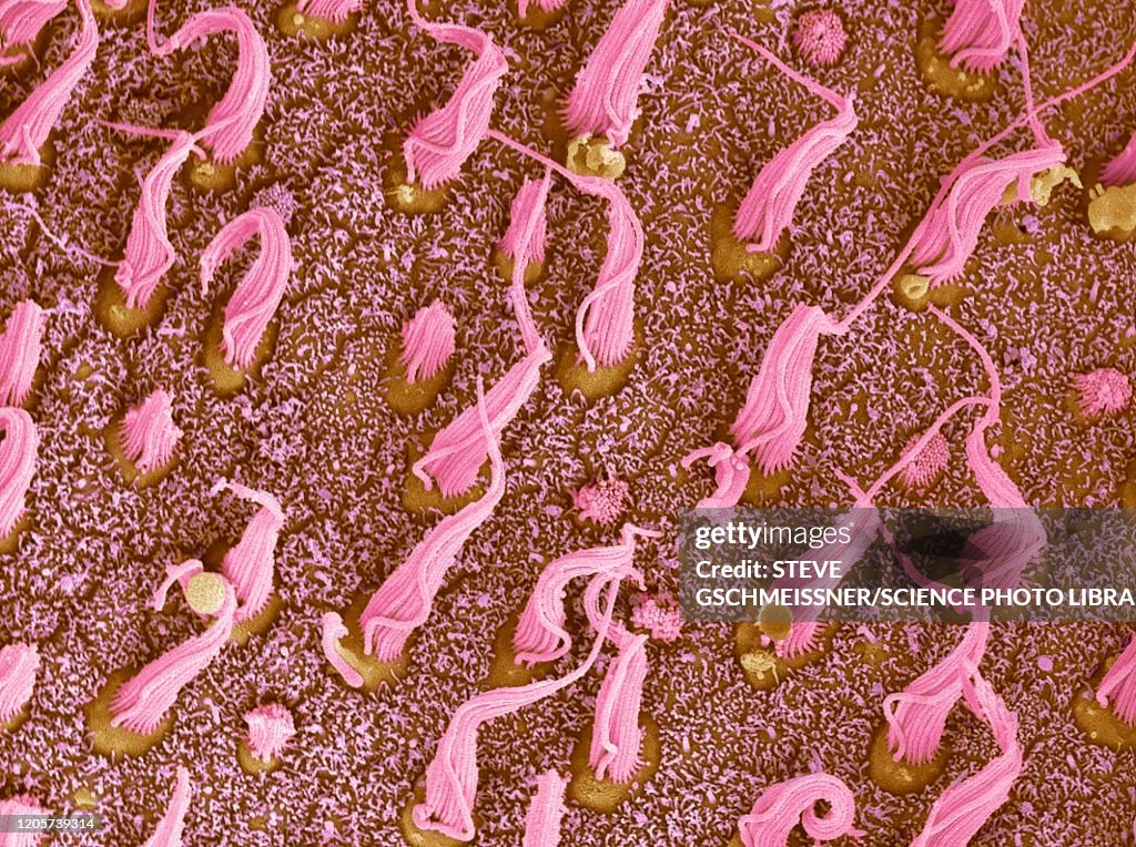 Inner ear sensory cells, SEM