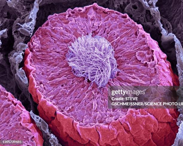 seminiferous tubules in the testis, sem - electron micrograph stock pictures, royalty-free photos & images