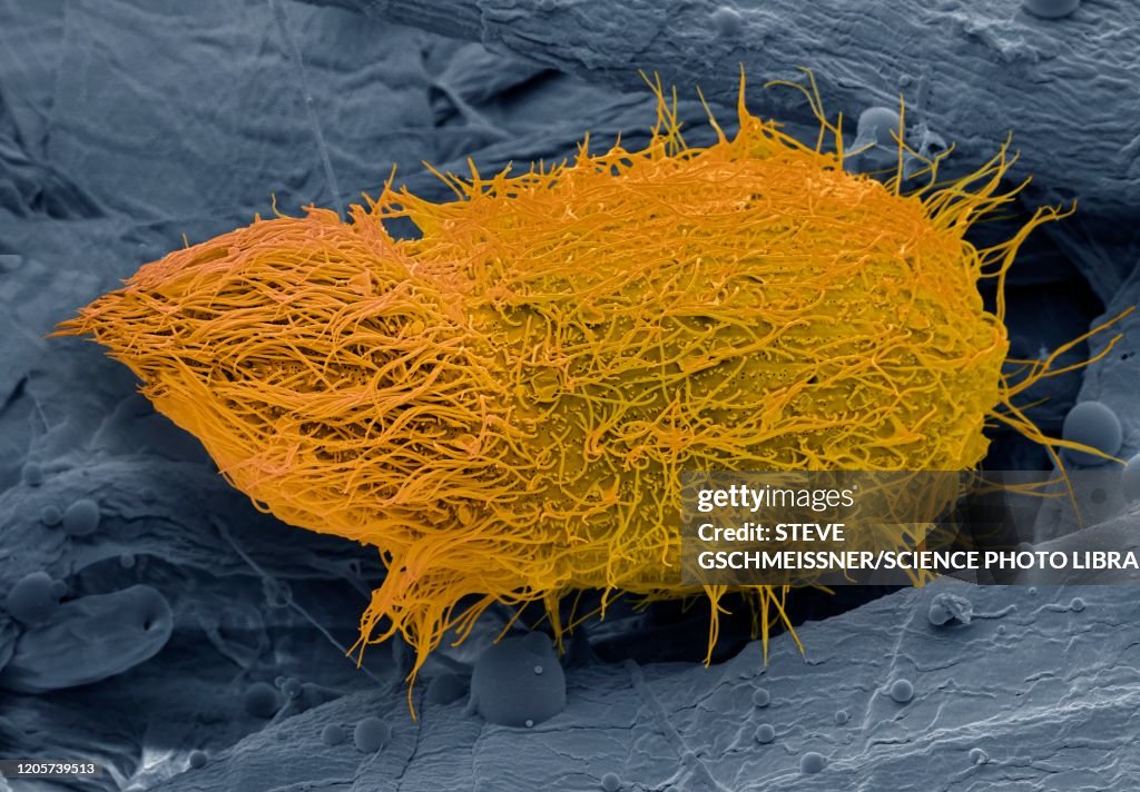 Loxophyllum ciliate protozoa, SEM