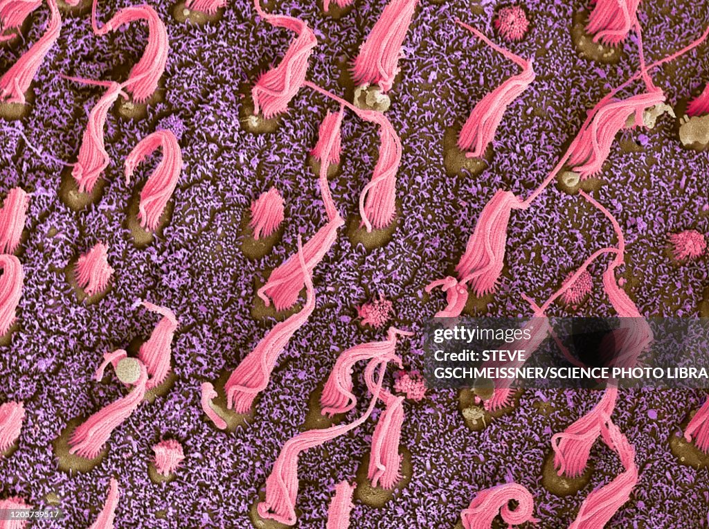 Inner ear sensory cells, SEM