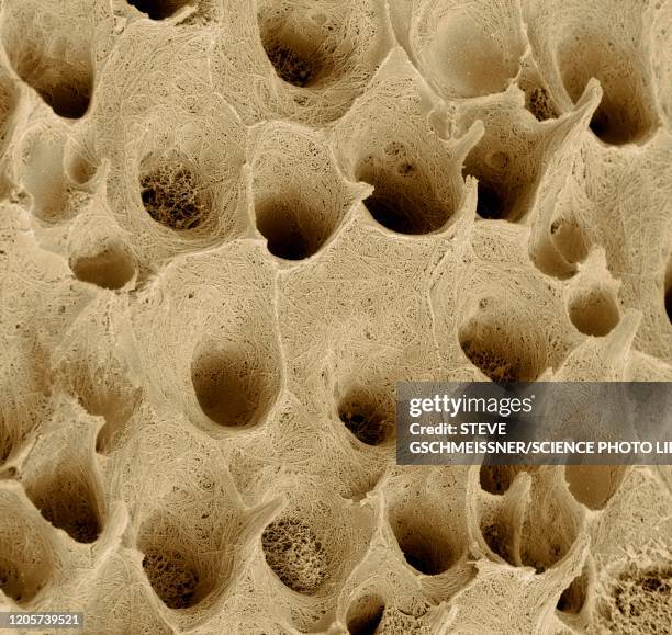Tooth Sem Tooth Dentin Photos and Premium High Res Pictures - Getty Images