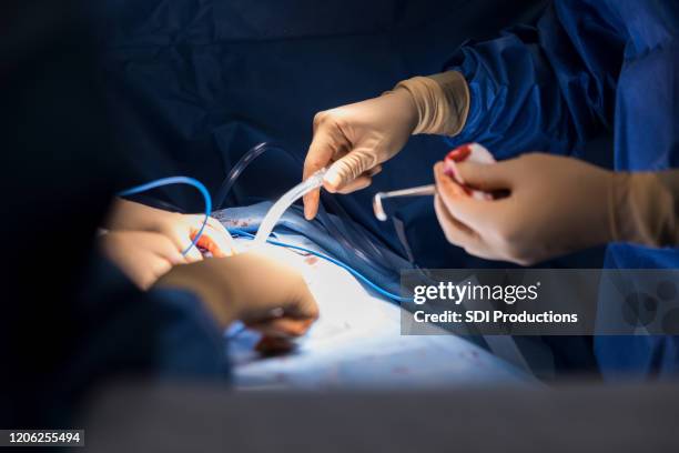 unrecognizable surgeon operates on patient - suction tube stock pictures, royalty-free photos & images