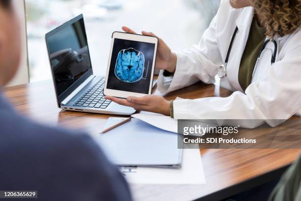 neurologe überprüft hirn-mrt-scan des patienten - alzheimer's disease stock-fotos und bilder