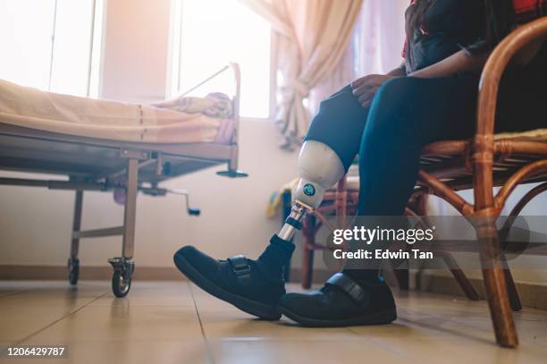 an asian indian person with prosthetic leg adjusting her artificial limb at hospital ward - artificial limb stock pictures, royalty-free photos & images