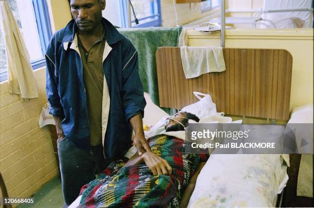Papua in Papua New Guinea - AIDS patient at Goroka Hospital. Aids looms as grimly as it does in Sub-Saharan Africa. Some experts are predicting that...
