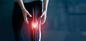 Woman suffering from pain in knee, Injury from workout and osteoarthritis, Tendon problems and Joint inflammation on dark background.