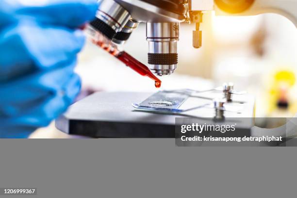 scientist analyzing blood sample in laboratory - hiv test 個照片及圖片檔