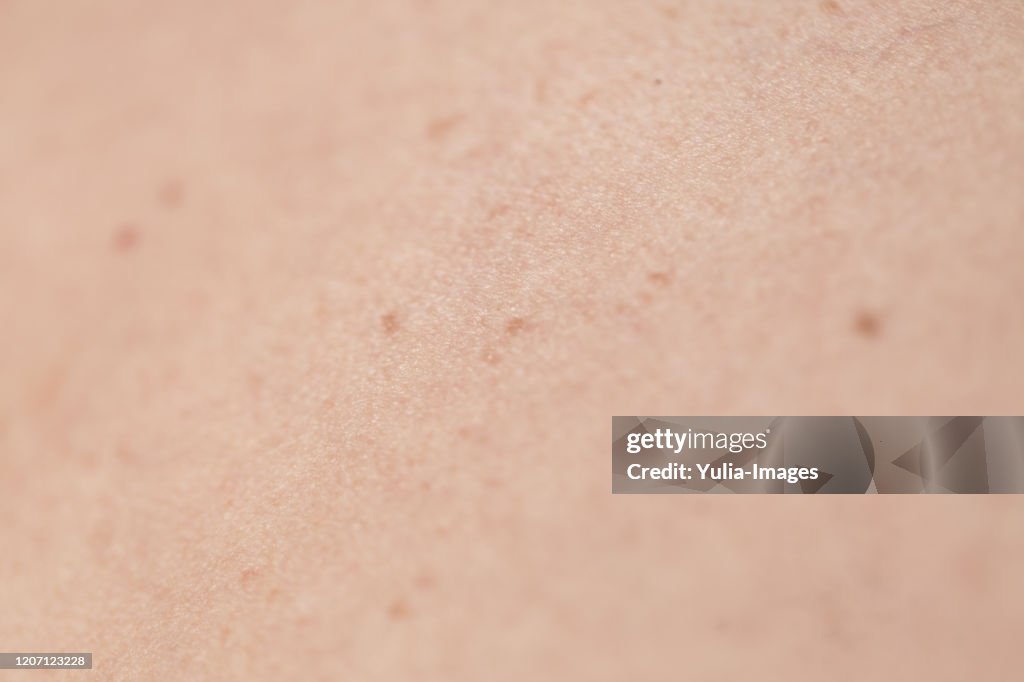 Close Up of Brown Mole on Surface of Human Skin