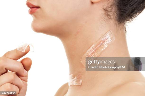 treatment for scars - schildklier stockfoto's en -beelden