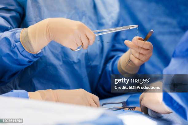 unrecognizable doctor prepares to stitch up incision - surgery stitches stock pictures, royalty-free photos & images