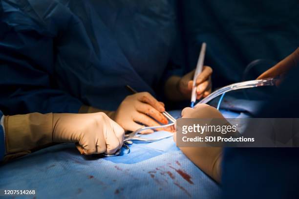 sitio de incisión resaltado por luces quirúrgicas brillantes - suction tube fotografías e imágenes de stock