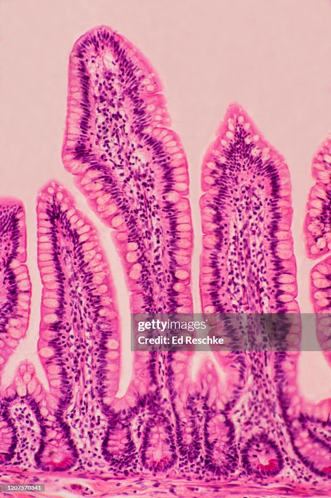 SMALL INTESTINE---VILLI, SIMPLE COLUMNAR EPITHELIUM, GOBLET CELLS, INTESTINAL GLANDS, PANETH CELLS, Ileum, Human, 50X