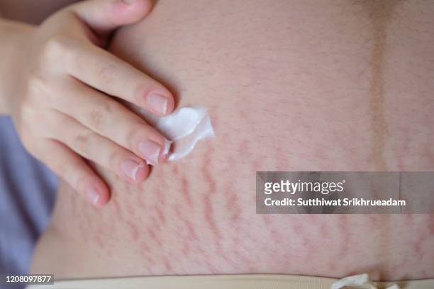 pregnant woman applying moisturizer on stretch marks - stretch mark stock pictures, royalty-free photos & images