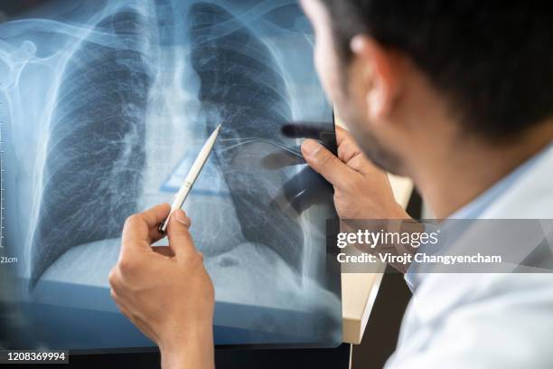 the doctor is analyzing the patient's lung x-rays, the flu concept or the covid-19 virus. - atmungsorgan stock-fotos und bilder