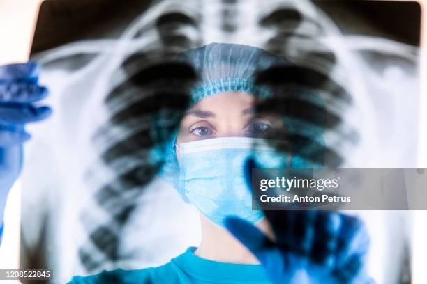 doctor in medical mask looking at x-ray of baby lungs - instrumento para diagnóstico imagens e fotografias de stock