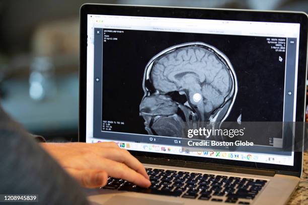 Ryan Westmoreland, the Red Sox top prospect until a cavernous malformation was found in his brain stem, looks at the original MRI that showing his...