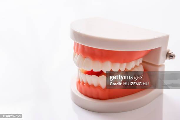 dental model - molde dental fotografías e imágenes de stock