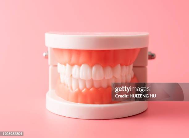 dental model - molde dental fotografías e imágenes de stock