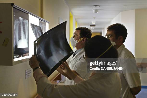 Le professeur Jean-Louis Vilde , chef du service des maladies infectieuses et tropicales de l'hôpital Bichat à Paris, et deux de ses médecins...