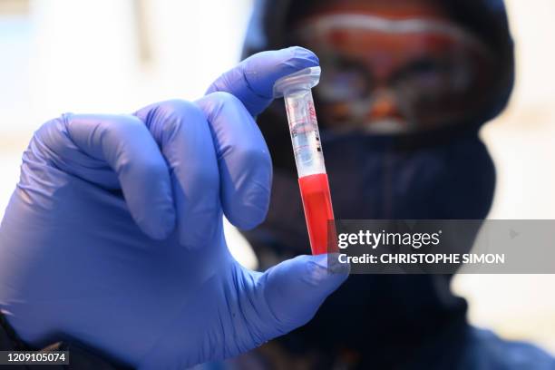 French firefighter from Marins Pompiers unit of Marseille wearing protective equipment shows a test tube as he working at the PCR machine on a mobile...