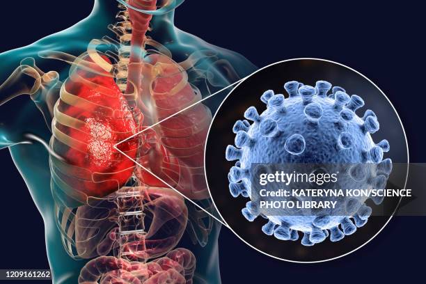 coronaviruses causing pneumonia, illustration - nucleocapsid stock illustrations