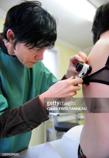 Une dermatologue observe à l'aide d'un dermatoscope un grain de beauté sur le dos d'une patiente, le 04 décembre 2008 à Quimper. Cinq critères,...