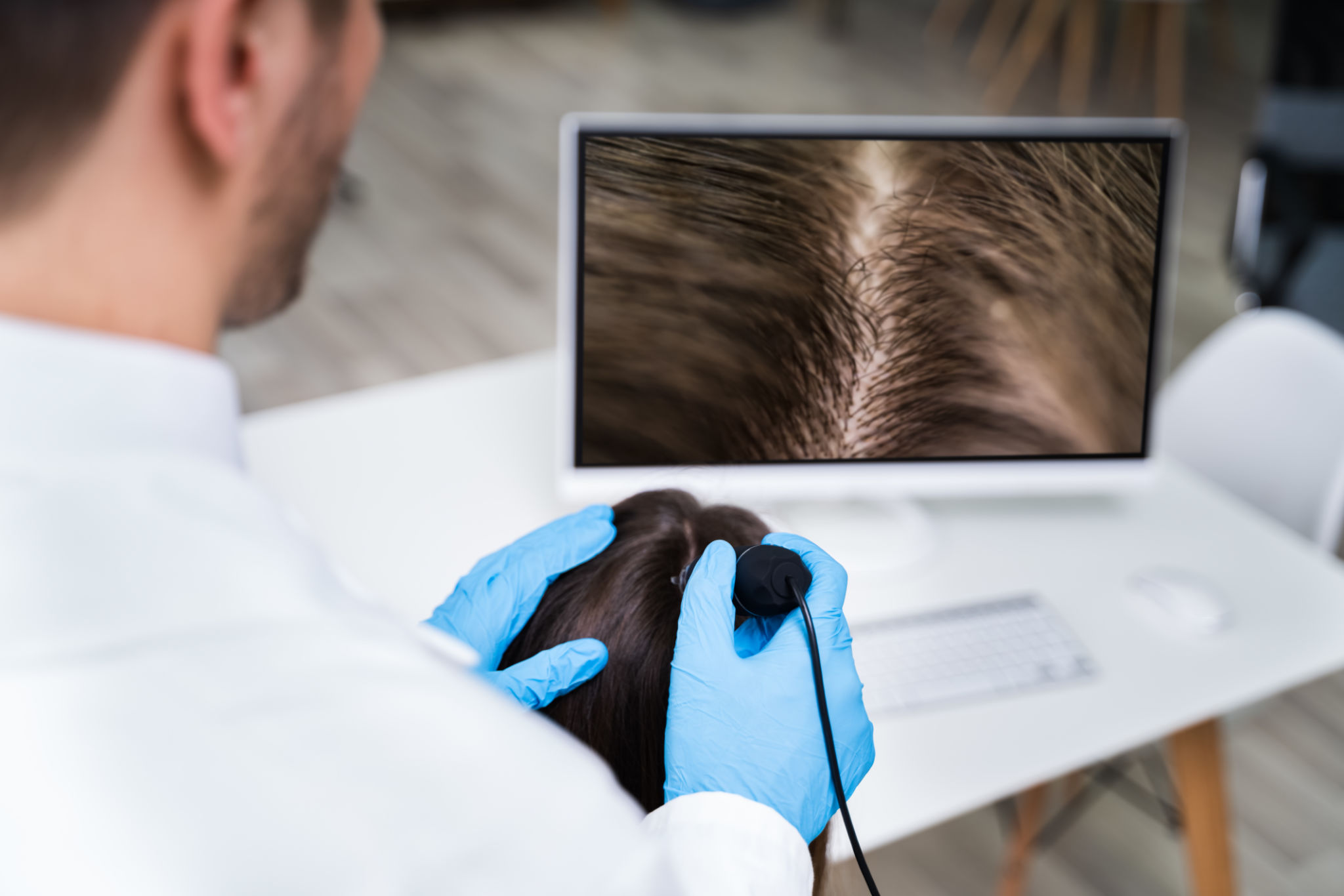 Dermatologist Using Trichoscope For Hair Fall Treatment Dermatologist Using Trichoscope For Hair Fall Treatment
