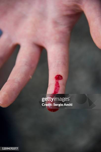 finger with berry juice looking like blood - osa peninsula stockfoto's en -beelden