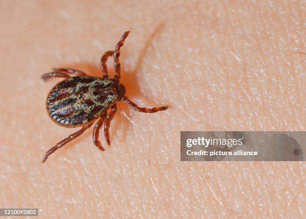 April 2020, Brandenburg, Sieversdorf: A tick crawls over the skin of a child. Photo: Patrick Pleul/dpa-Zentralbild/ZB