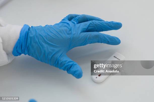 An antibody test for COVID-19 is seen at the Dworska Hospital in Krakow, Poland on the April 16, 2020. The Chinese plate test is a serologic,...
