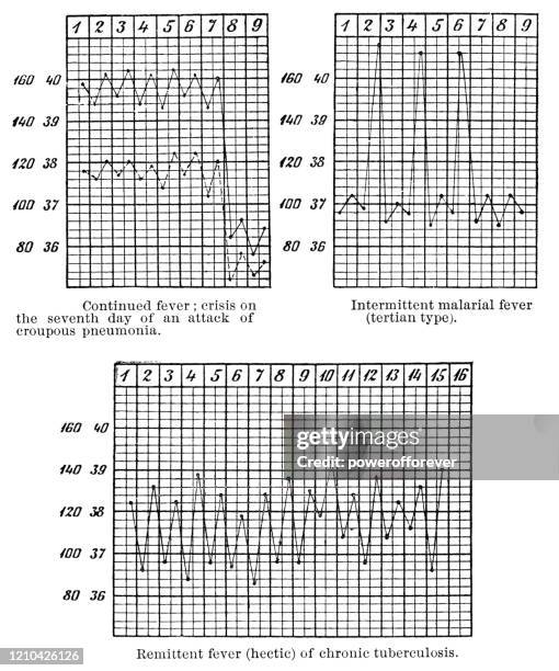 ilustrações, clipart, desenhos animados e ícones de gráficos mostrando padrões de temperatura de diferentes tipos de febre - século xix - diagramas médicos