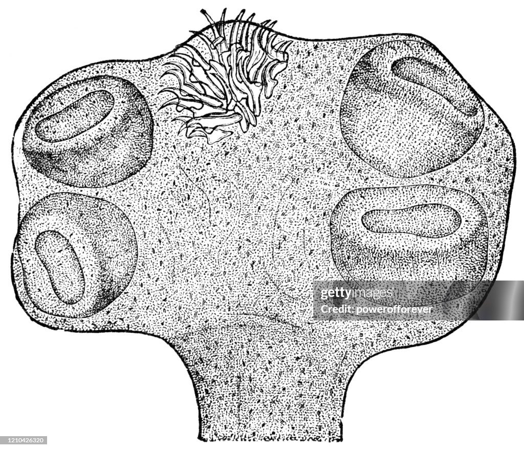 The Head of a Tapeworm Larvae - 19th Century