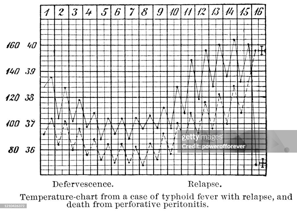 Temperature Chart of Patient With a Relapse of Typhoid Fever and Eventual Death - 19th Century