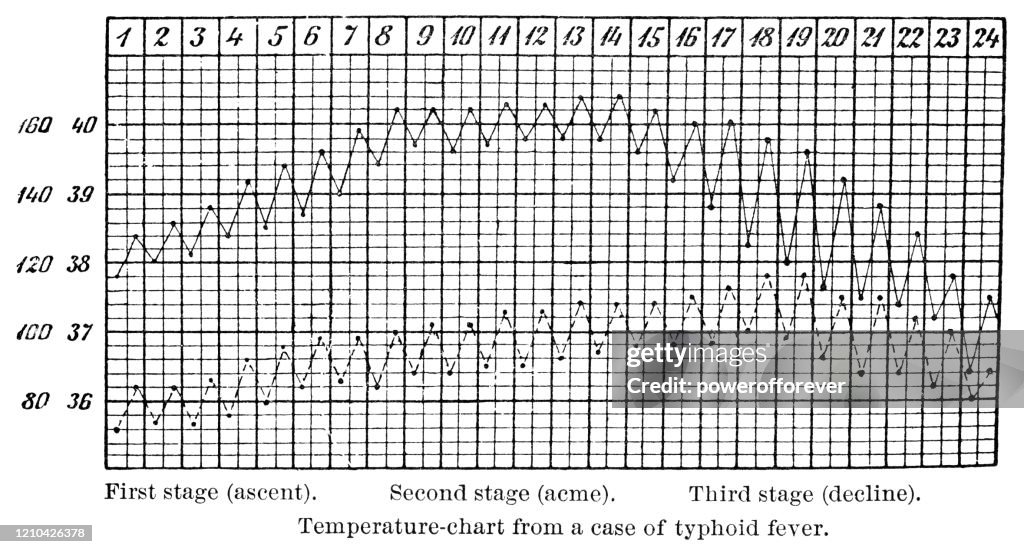 Temperature Chart of Patient With Typhoid Fever - 19th Century