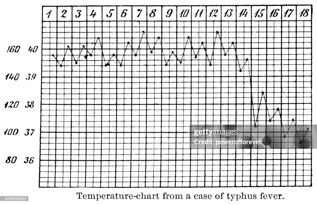 Temperature Chart of Patient With Typhus Fever - 19th Century