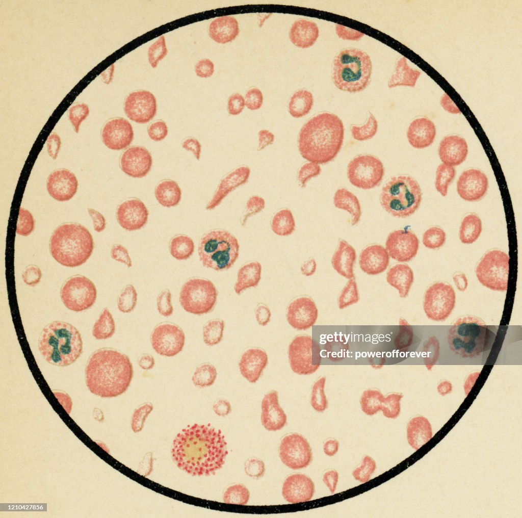 Human With Rbc Image Human Red Blood Cells