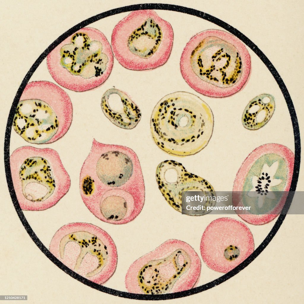 Microscopic View of Eukaryote Cells from a Patient with Malaria, Stained with Methylene Blue - 19th Century