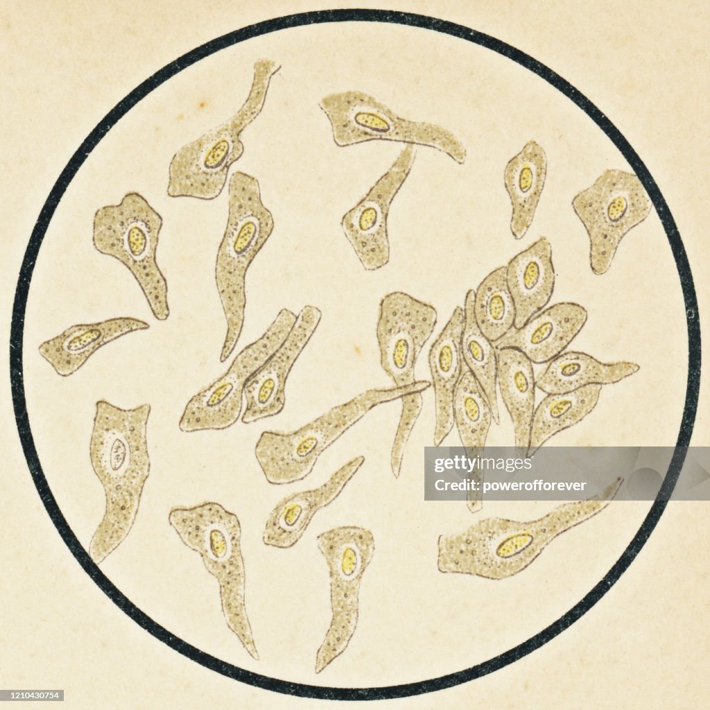 Mikroskopische Ansicht der menschlichen Pseudostratifizierten Epithelzellen aus dem Becken und der Niere - 19. Jahrhundert