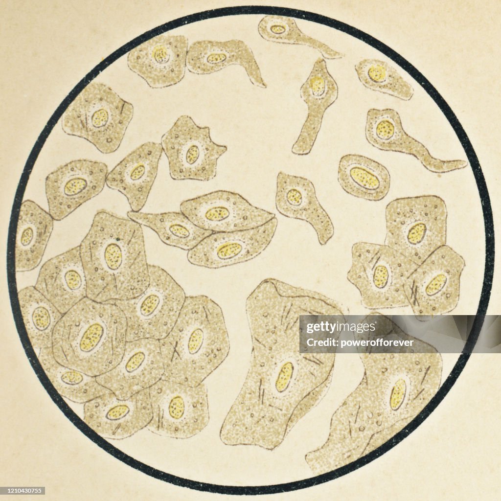 Microscopic View of Human Squamous Epithelium Cells from the Urethra and Bladder - 19th Century