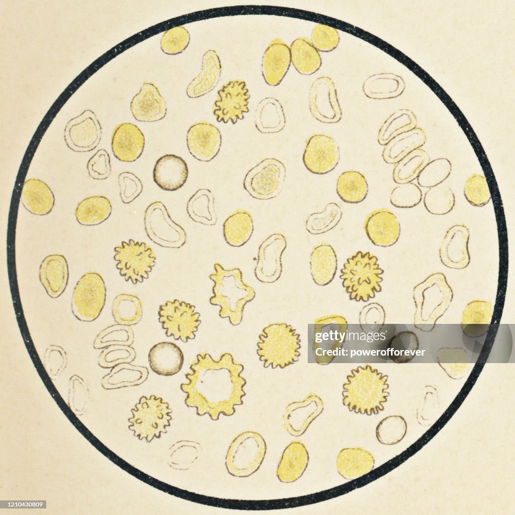 Microscopic View of Human Red Blood Cells - 19th Century